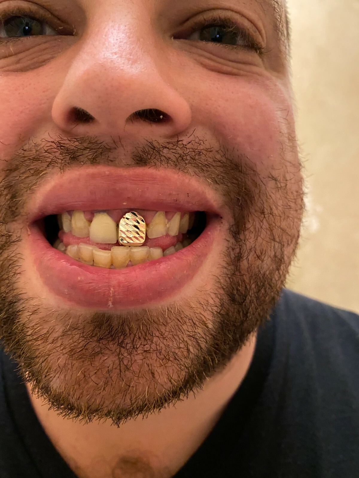 SOLID 925 Sterling Silver Single Tooth Grillz Hip Hop Grill Cap Gold Plated REAL