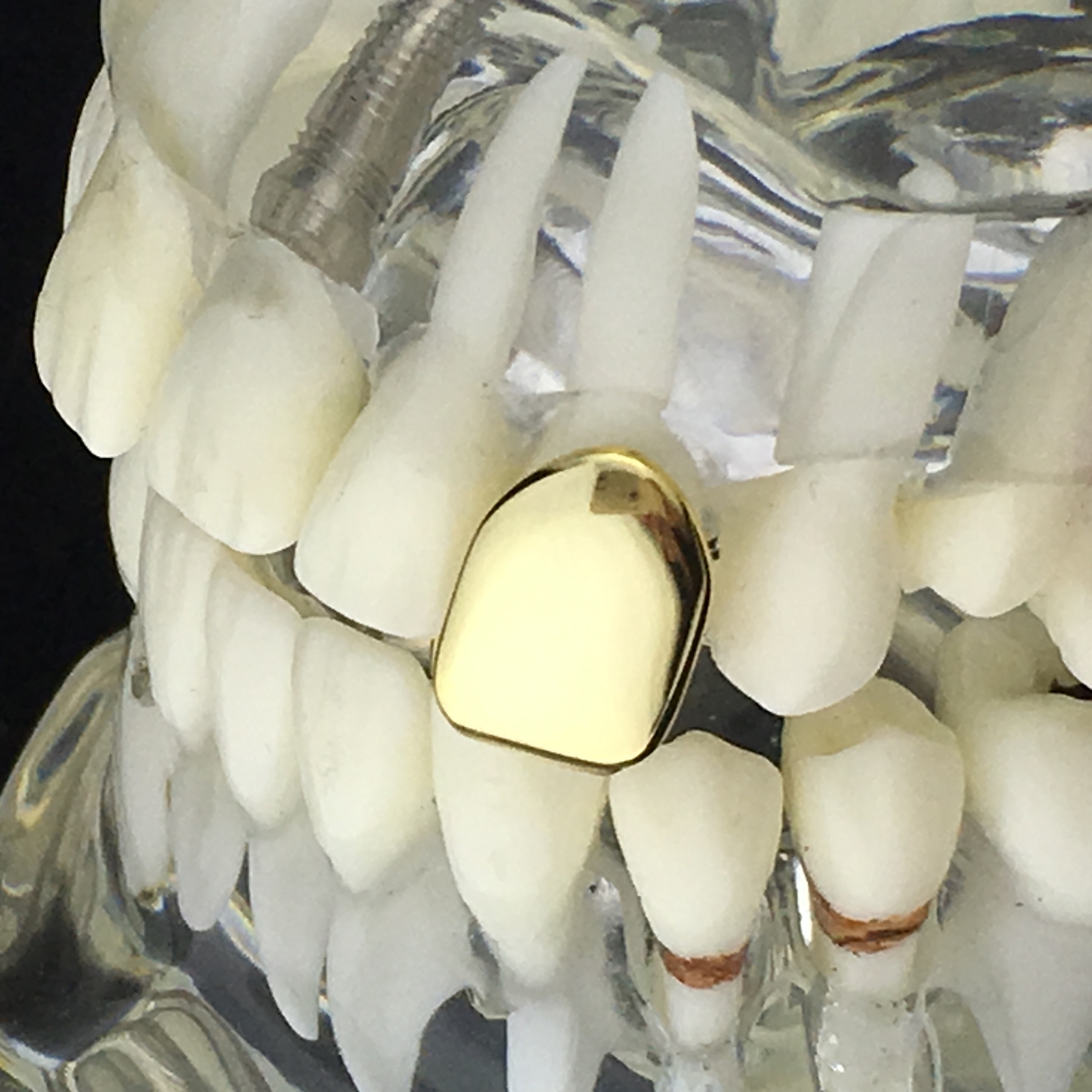 14K Gold Plated Tooth Cap Solid Real 925 Sterling Silver Single One Tooth Grillz