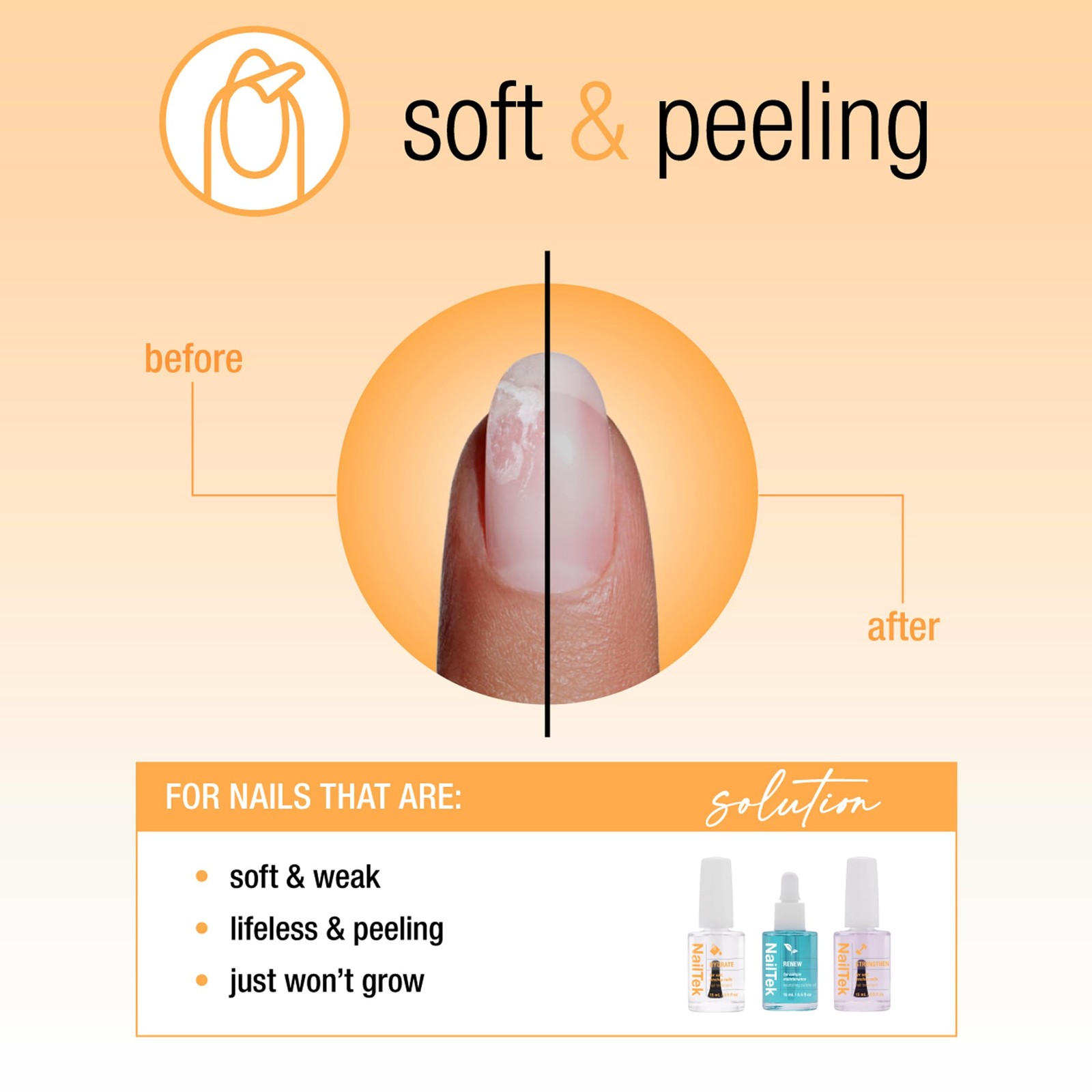 Nail Tek Recovery Kit: Repair Damaged Nails, Hydrate, Renew & Strengthen