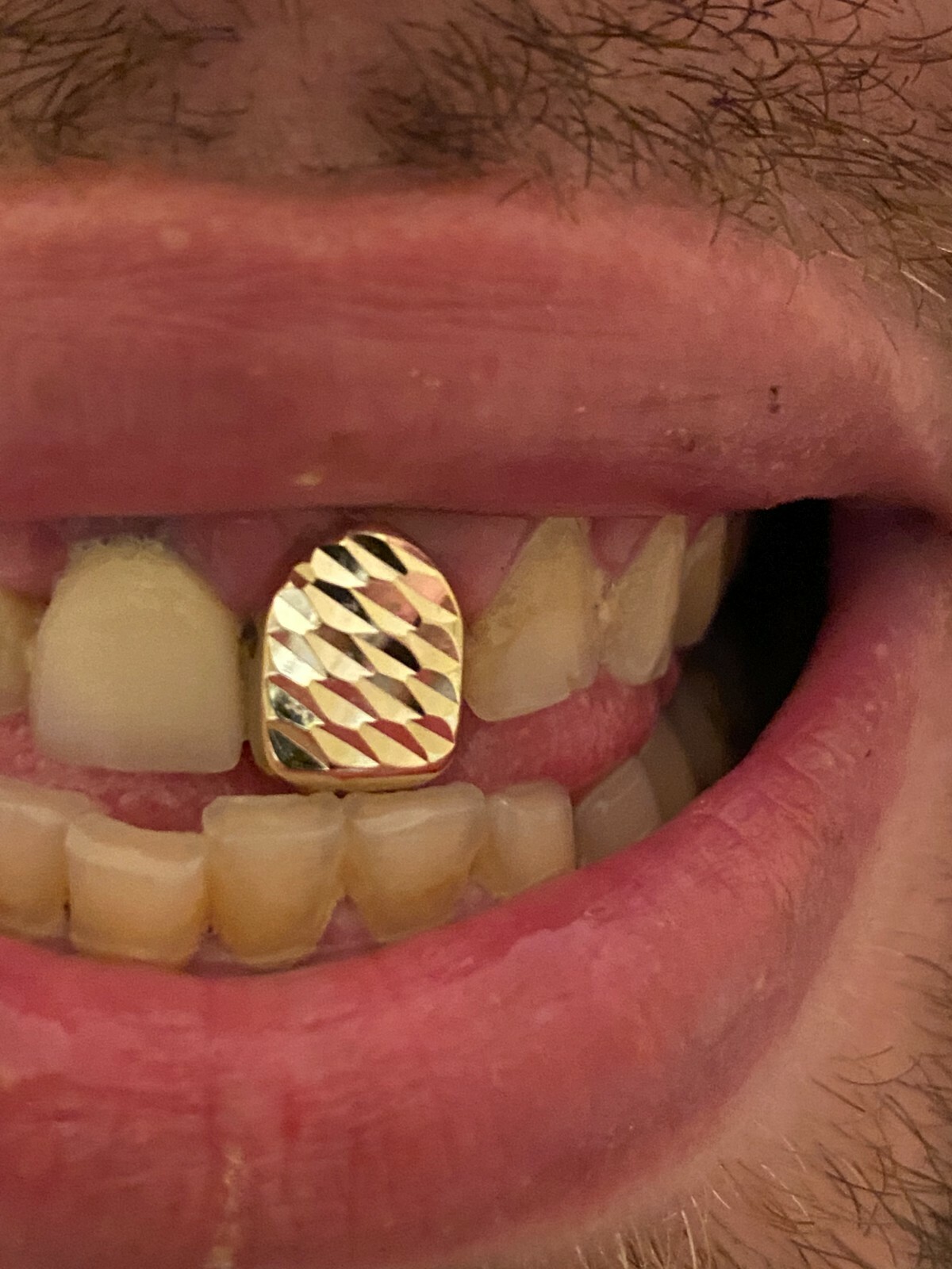 SOLID 925 Sterling Silver Single Tooth Grillz Hip Hop Grill Cap Gold Plated REAL