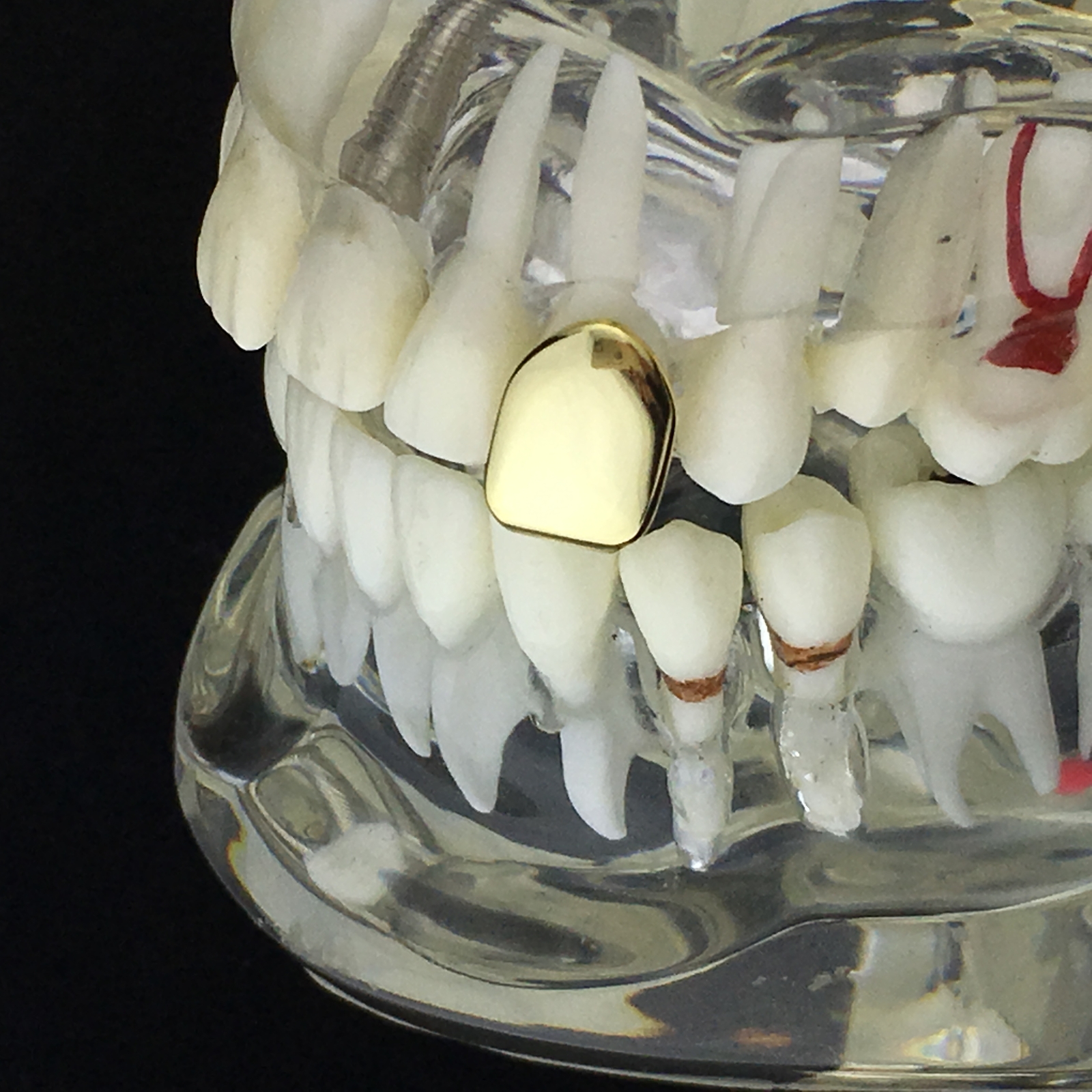 14K Gold Plated Tooth Cap Solid Real 925 Sterling Silver Single One Tooth Grillz