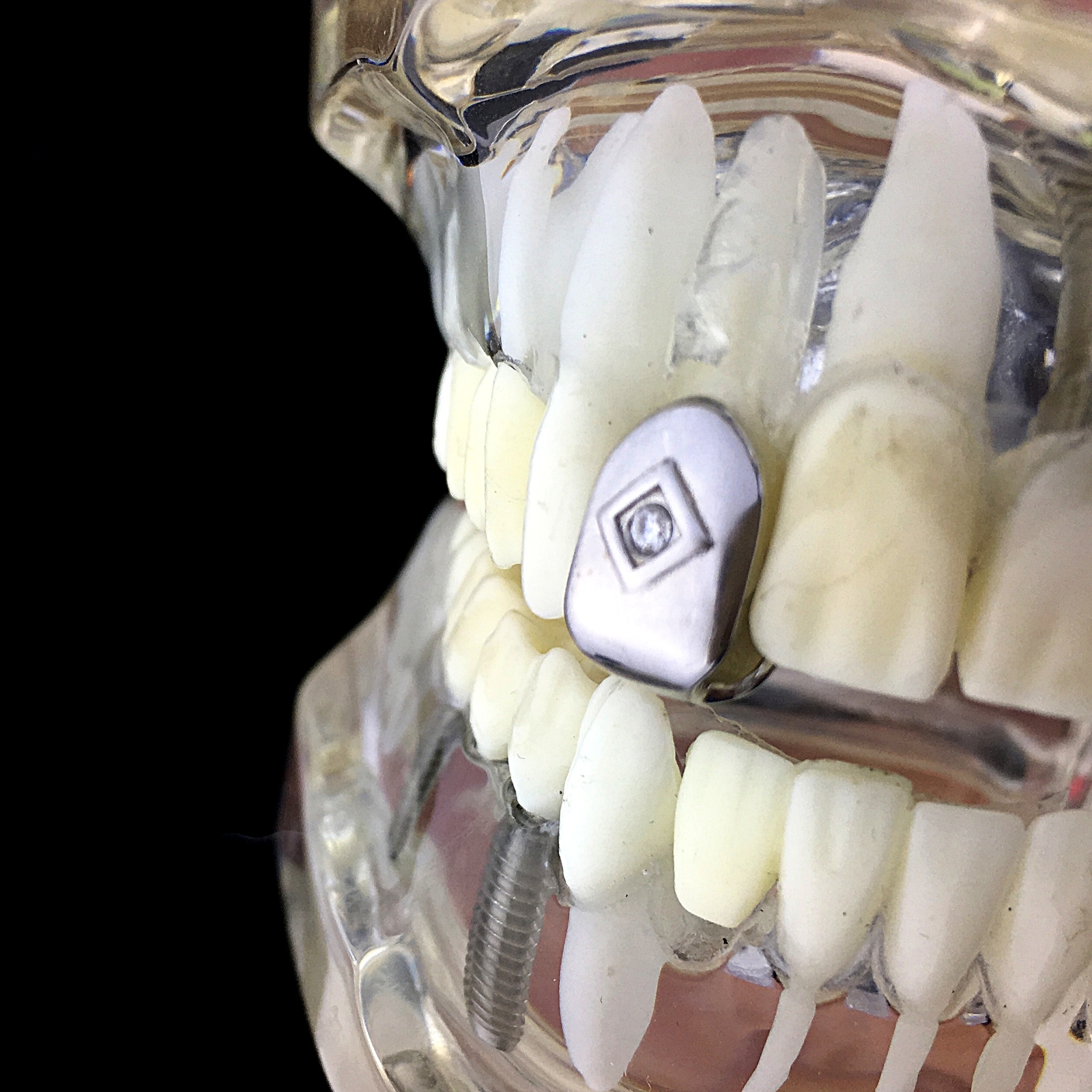 Real Solid 925 Sterling Silver Single Tooth Center CZ Iced Cap Teeth Slug Grillz