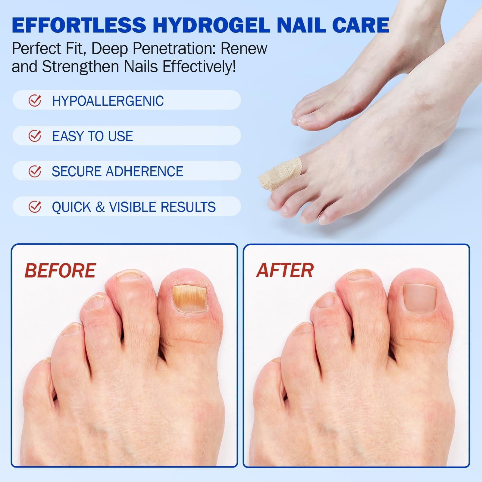 Nail Patches 42 PCS Toenail Treatment Extra Strength 8-Hour Overnight Fast Repai