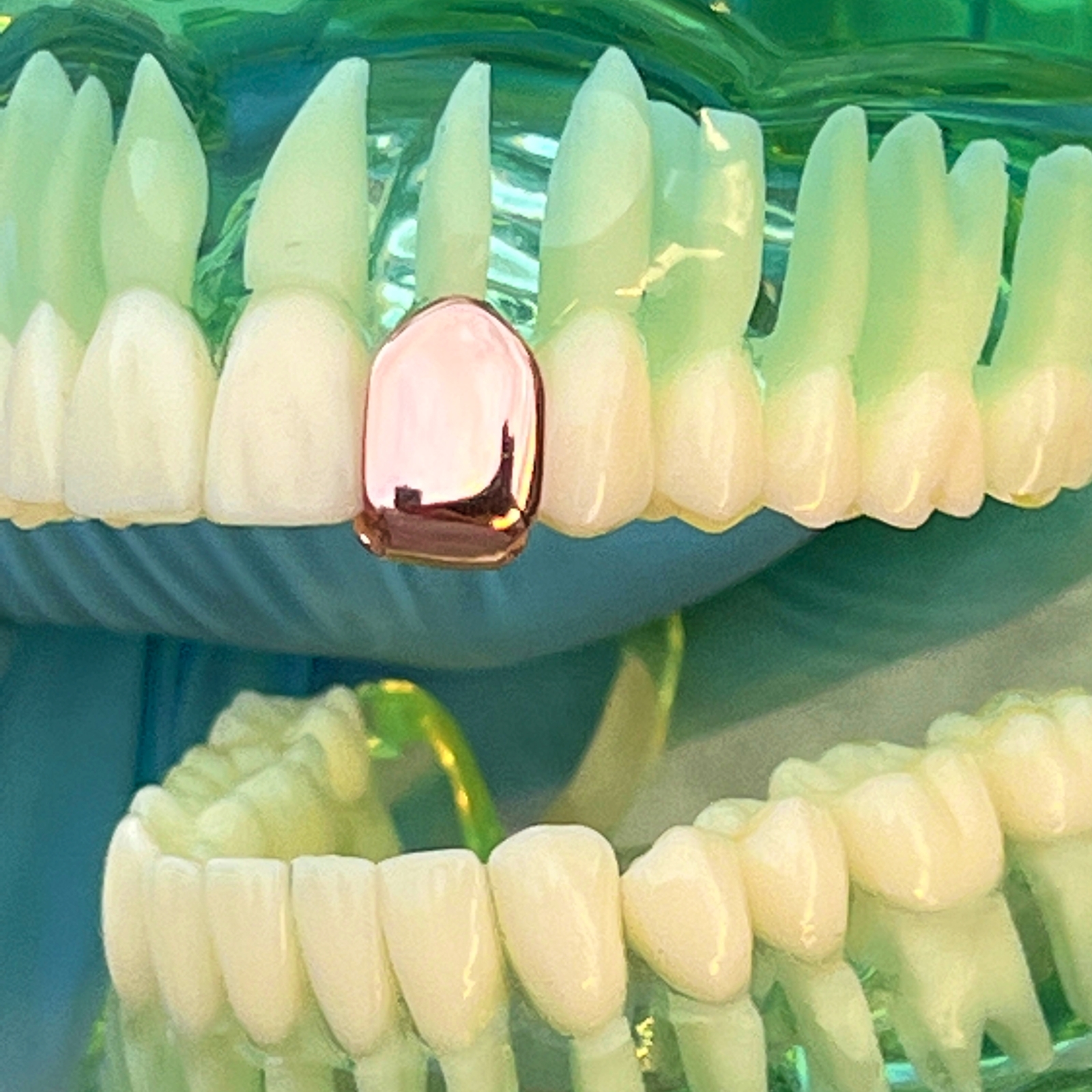 14K Rose Gold Plated Tooth Cap Real 925 Sterling Silver Single One Tooth Grillz