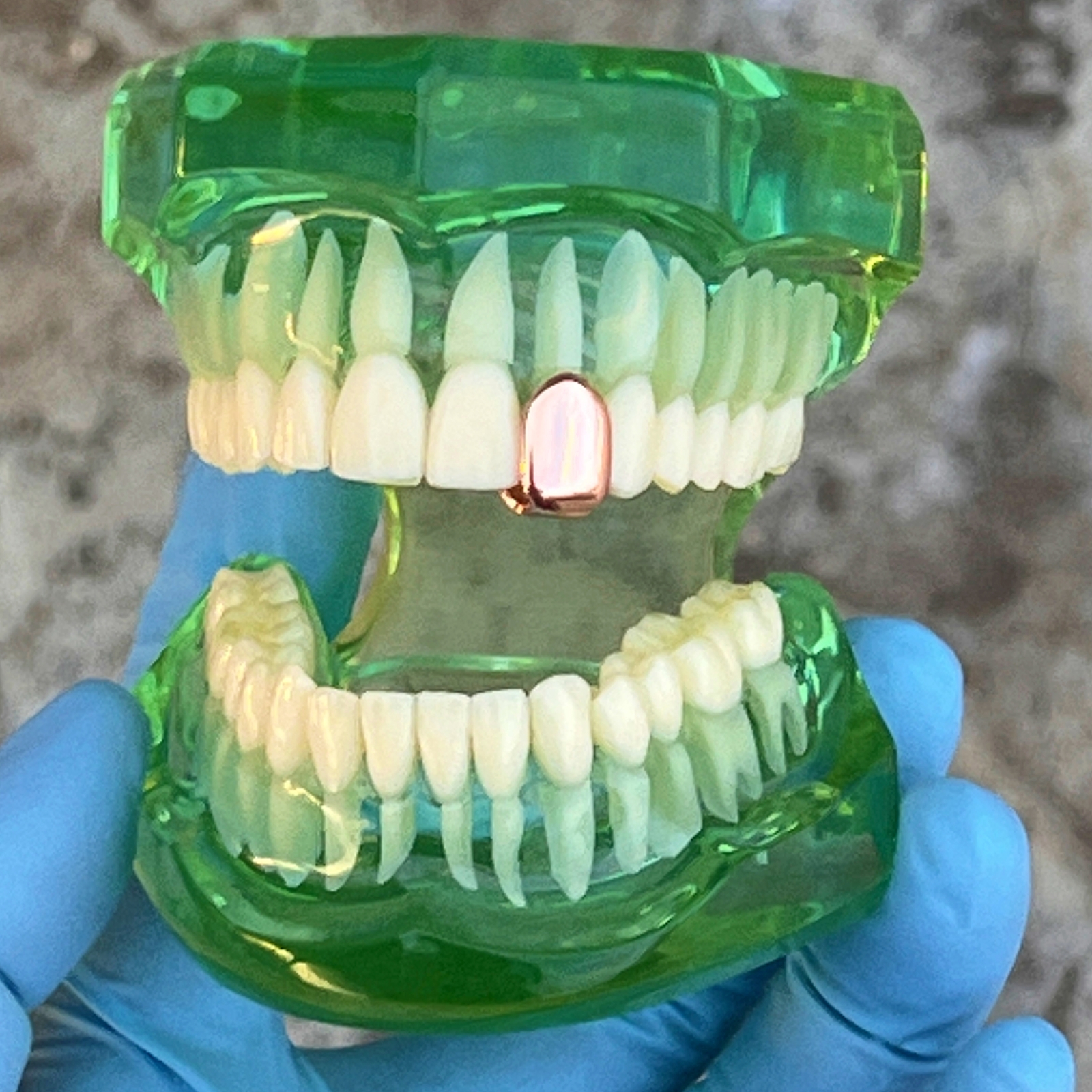 14K Rose Gold Plated Tooth Cap Real 925 Sterling Silver Single One Tooth Grillz