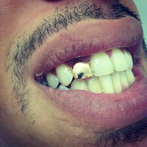 Real 925 Sterling Silver Gold Plated GRILLZ – Hip Hop Grills 6 8 Or Single Teeth