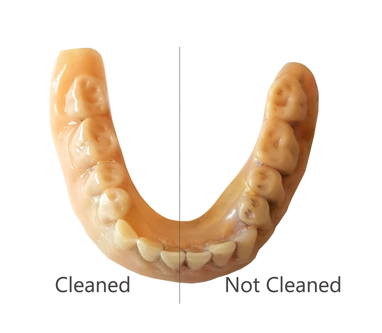 iSonic F3900 Ultrasonic Denture/Aligner/Retainer Cleaner for all dental and s…