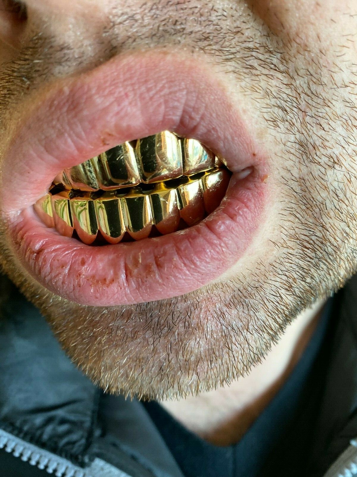 Real 925 Sterling Silver Gold Plated GRILLZ – Hip Hop Grills 6 8 Or Single Teeth