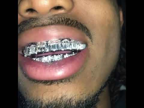 Real Solid Hip Hop 925 Sterling Silver Grillz Baguette Diamond Iced Grills Set