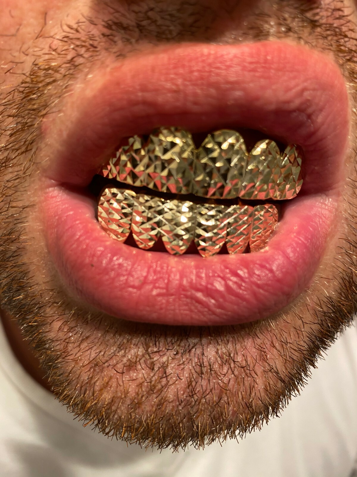 REAL 14k Gold Plated Solid 925 Sterling Silver Diamond Cut Grillz Teeth Fronts