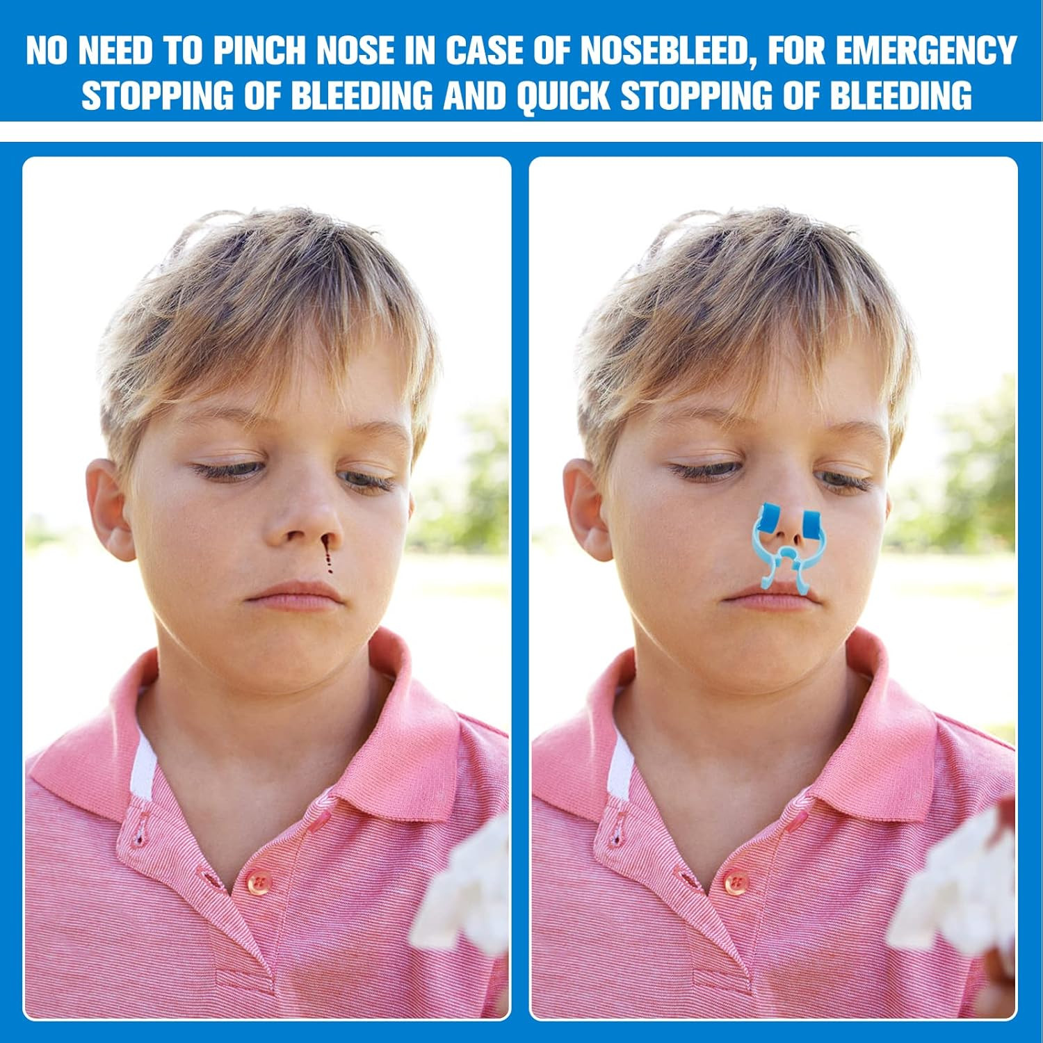 10 Pieces Nose Stop Clips, Nose Bleed Stopper Swimming Nose Clip for Adult an…