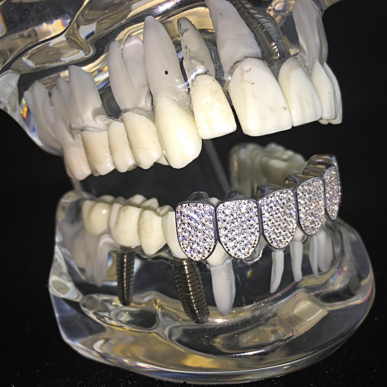 Real 925 Sterling Silver Grillz Micro Pave Iced Flooded Out CZ Bottom Teeth