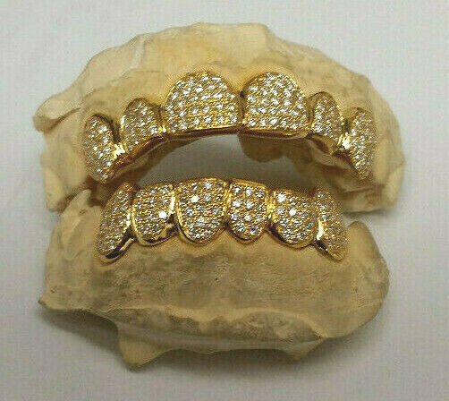 14K Solid Yellow or White Gold 6pc Top REAL Diamond GRILLZ Gold Teeth