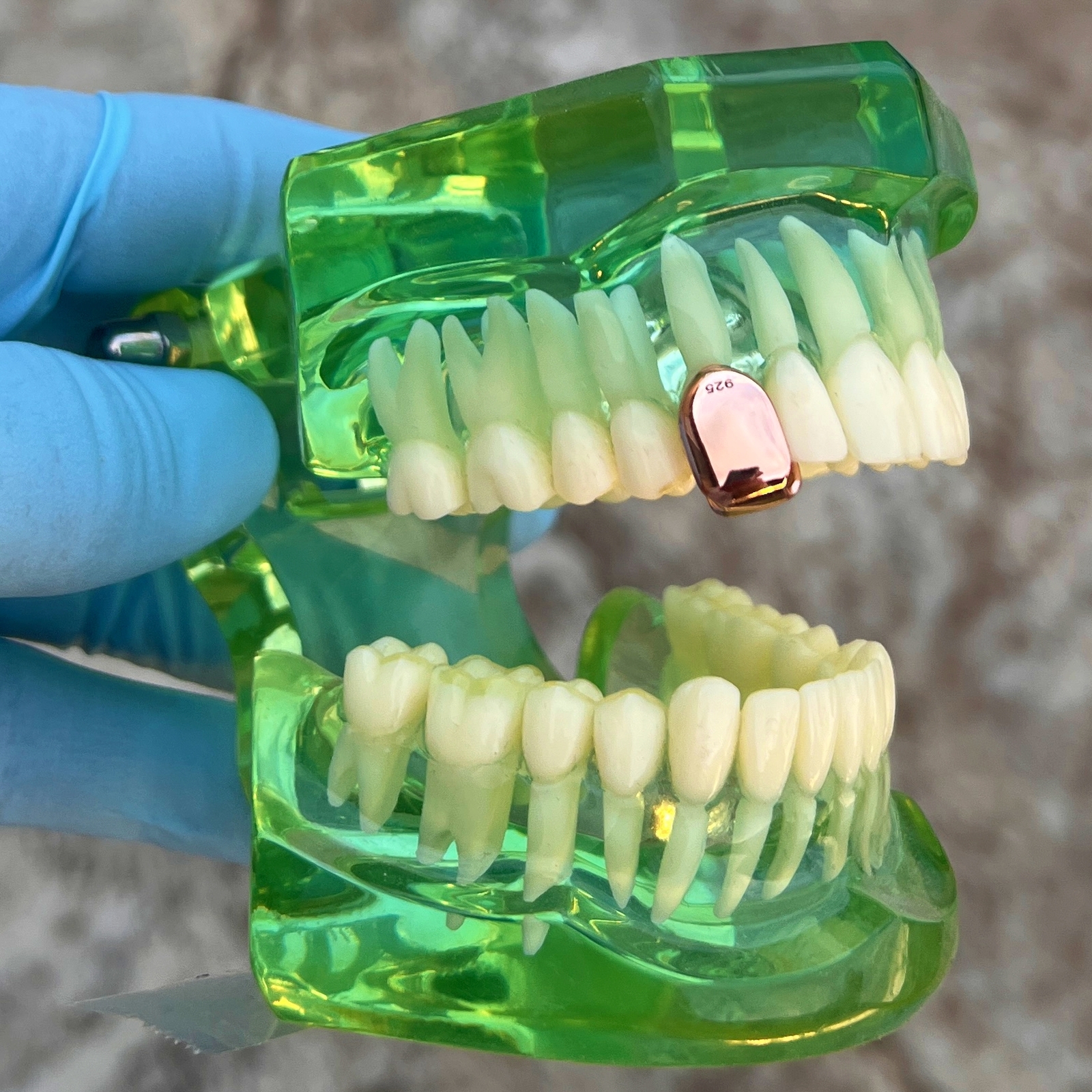 14K Rose Gold Plated Tooth Cap Real 925 Sterling Silver Single One Tooth Grillz