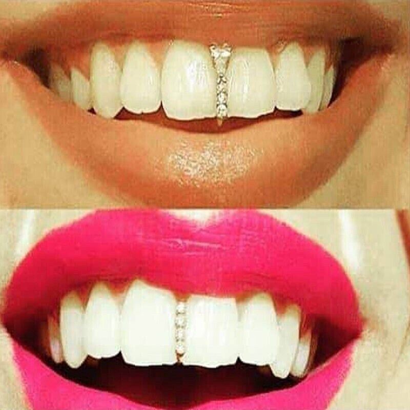 Braces Tooth Cap Jewel Teeth Cover Cosplay Single Teeth Case Teeth Caps Grills