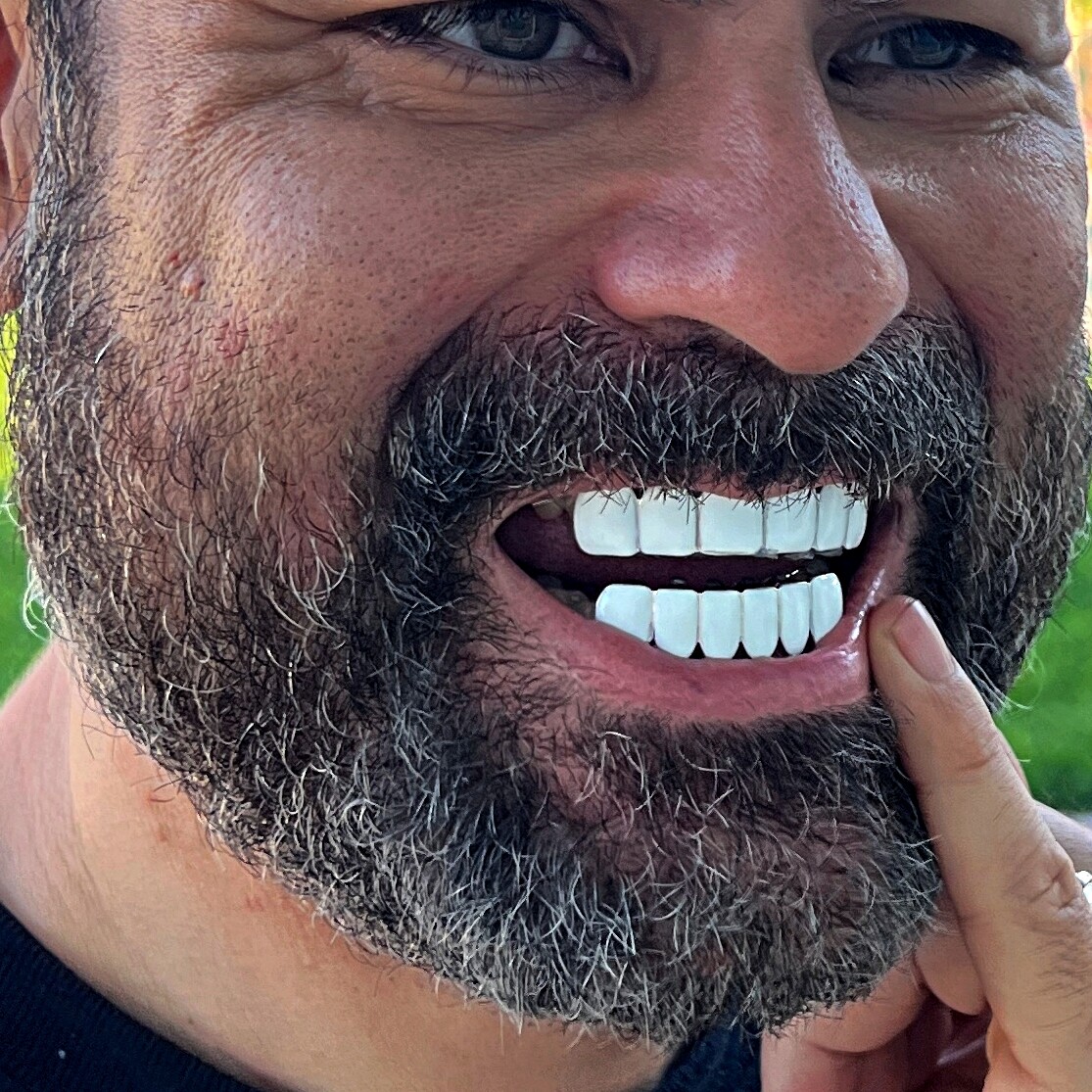 Real Solid 925 Sterling Silver White Enamel Grillz Top & Bottom Teeth Grills Set