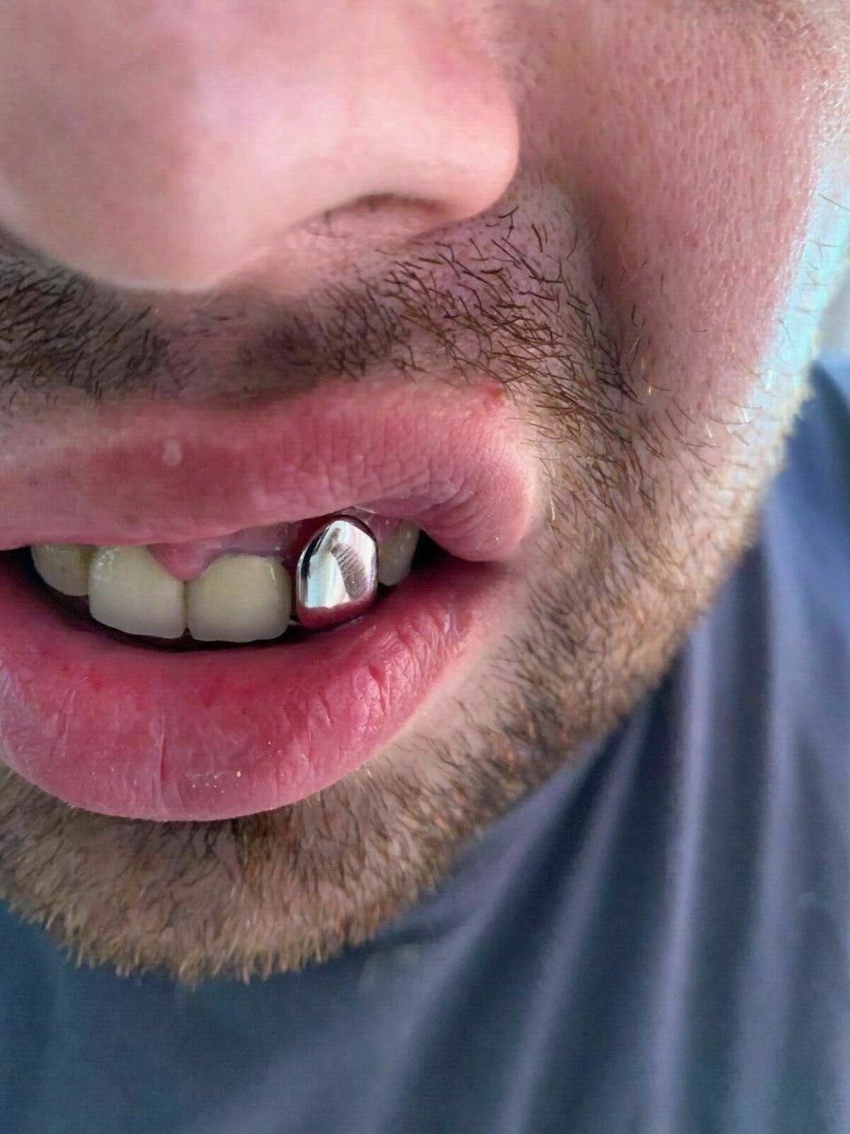 Real 925 Sterling Silver – GRILLZ Top Bottom Hip Hop Grills 6 8 Or Single Teeth
