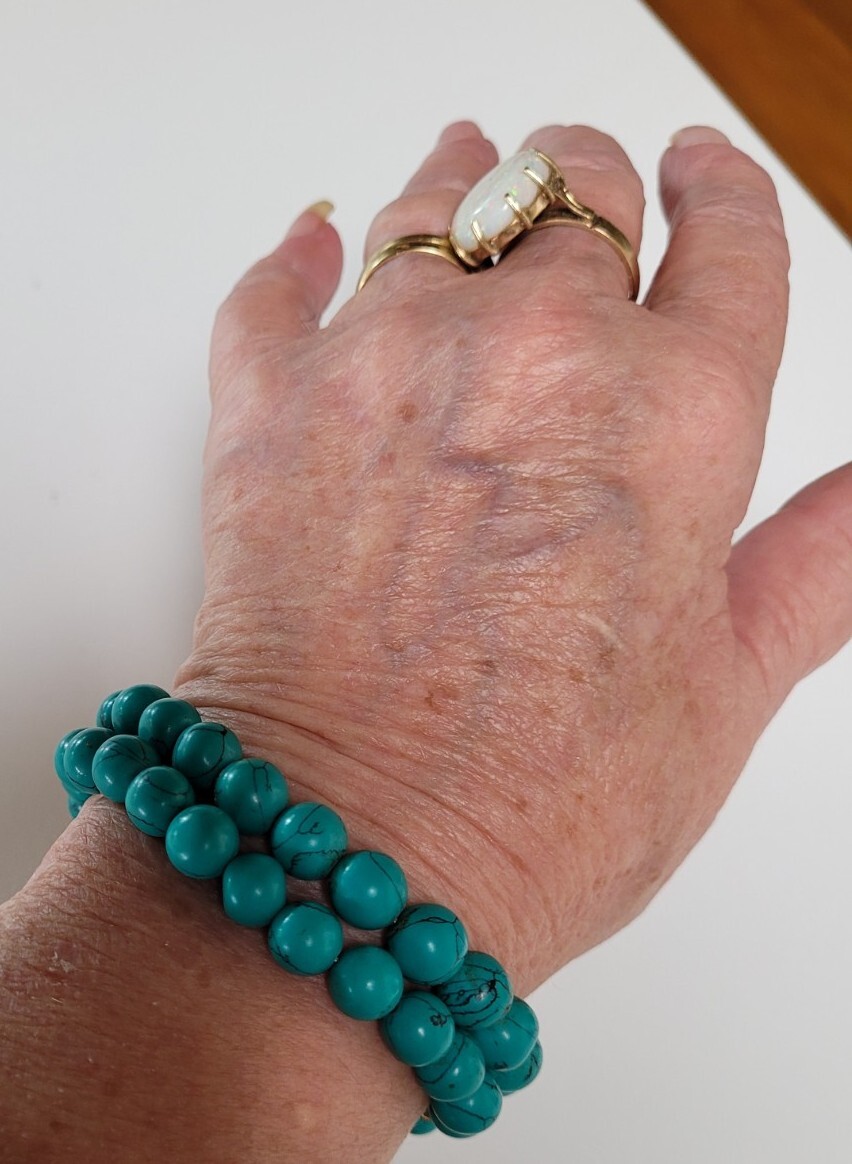 Vintage 45cm Blue Green Teal 180 Carat Turquoise Howlite 9mm Bead Necklace 39grm