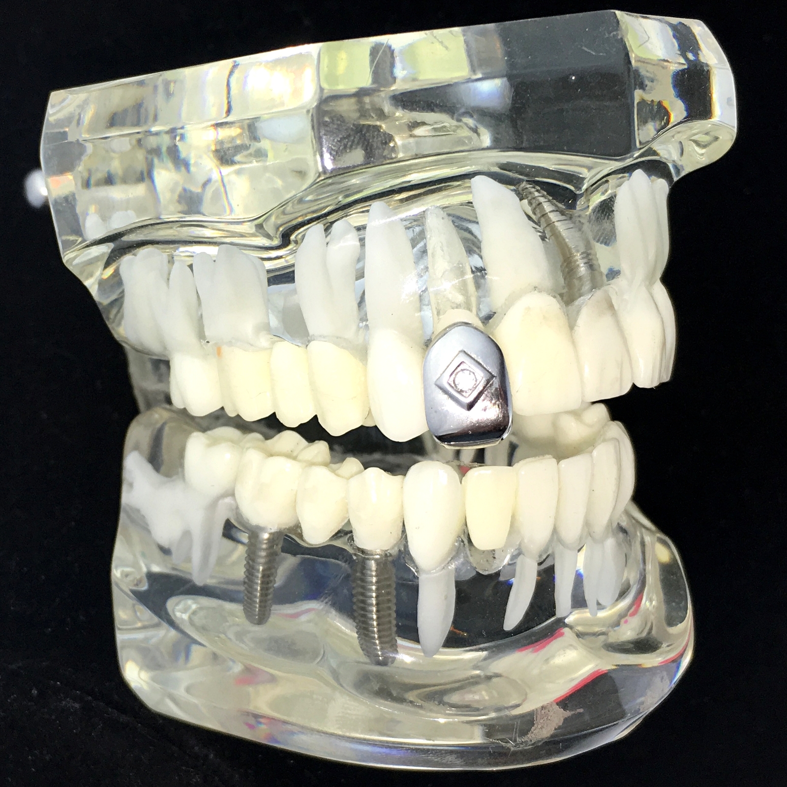 Real Solid 925 Sterling Silver Single Tooth Center CZ Iced Cap Teeth Slug Grillz