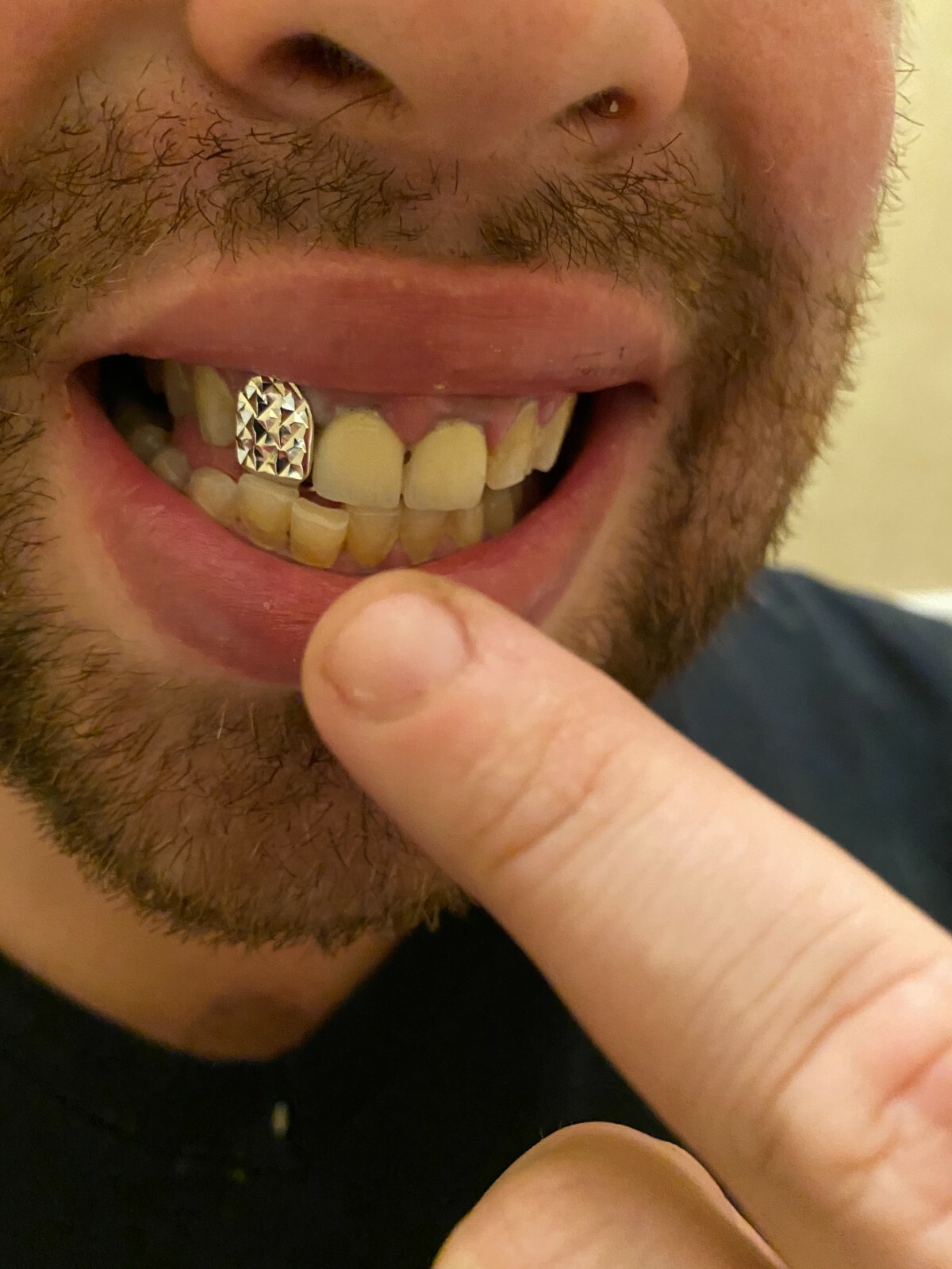 SOLID 925 Sterling Silver Single Tooth Grillz Hip Hop Grill Cap Diamond Cut REAL