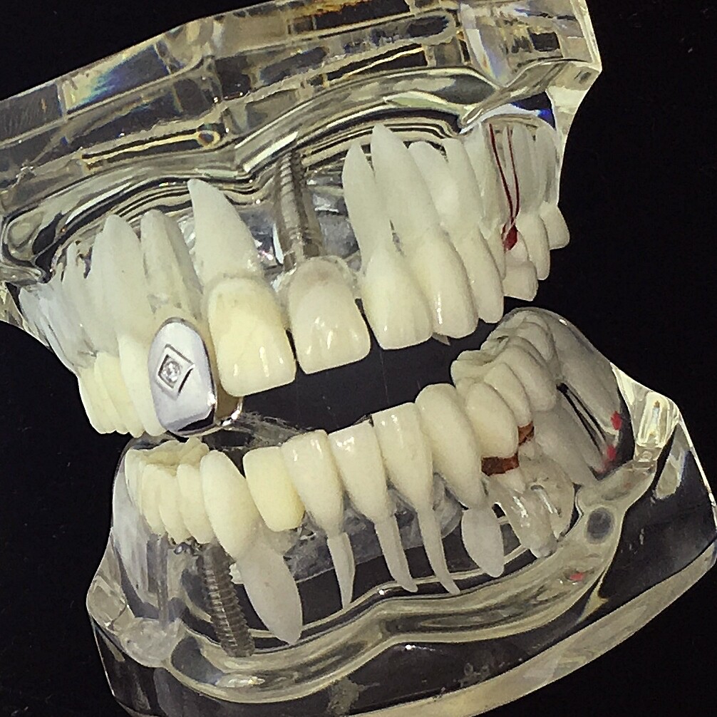 Real Solid 925 Sterling Silver Single Tooth Center CZ Iced Cap Teeth Slug Grillz