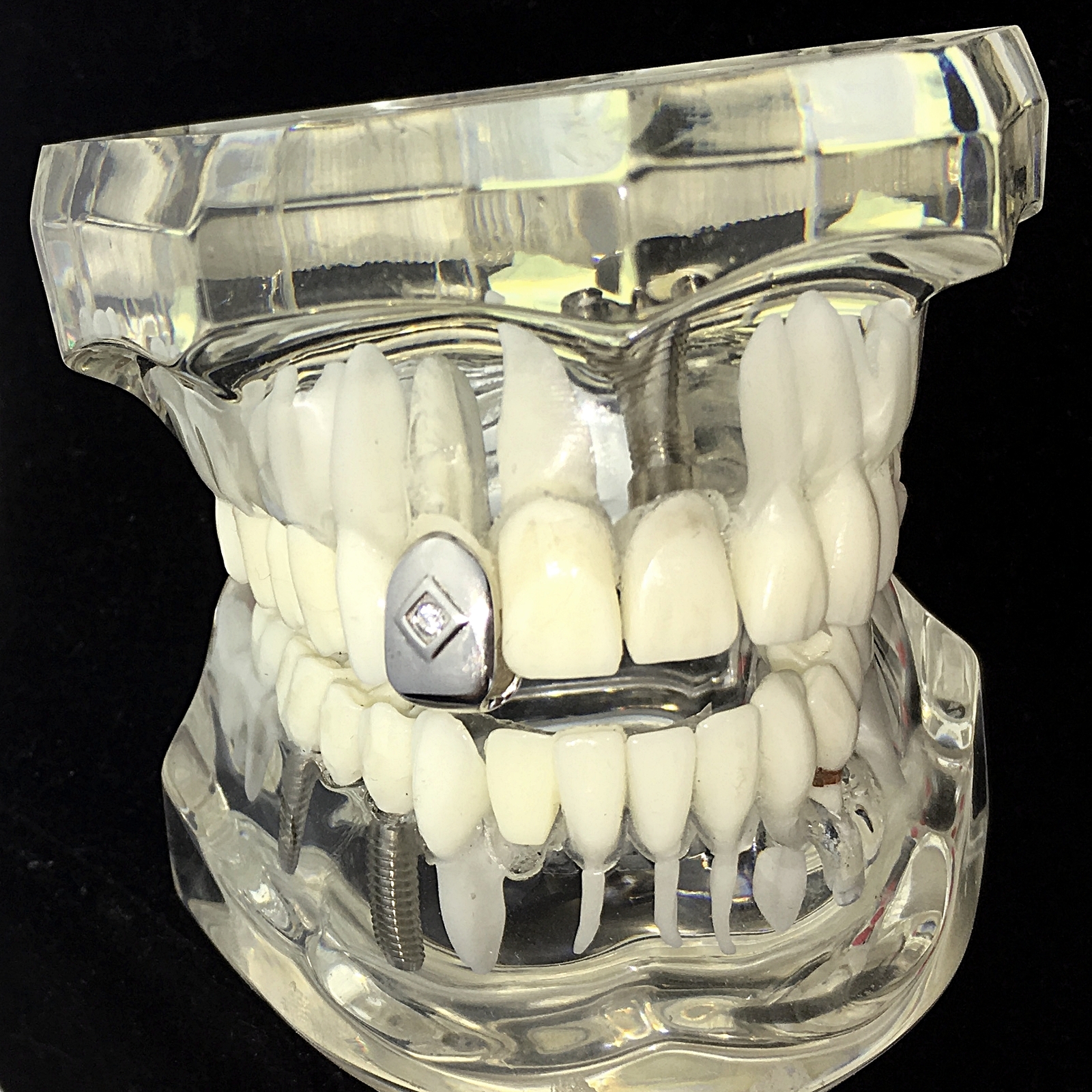Real Solid 925 Sterling Silver Single Tooth Center CZ Iced Cap Teeth Slug Grillz