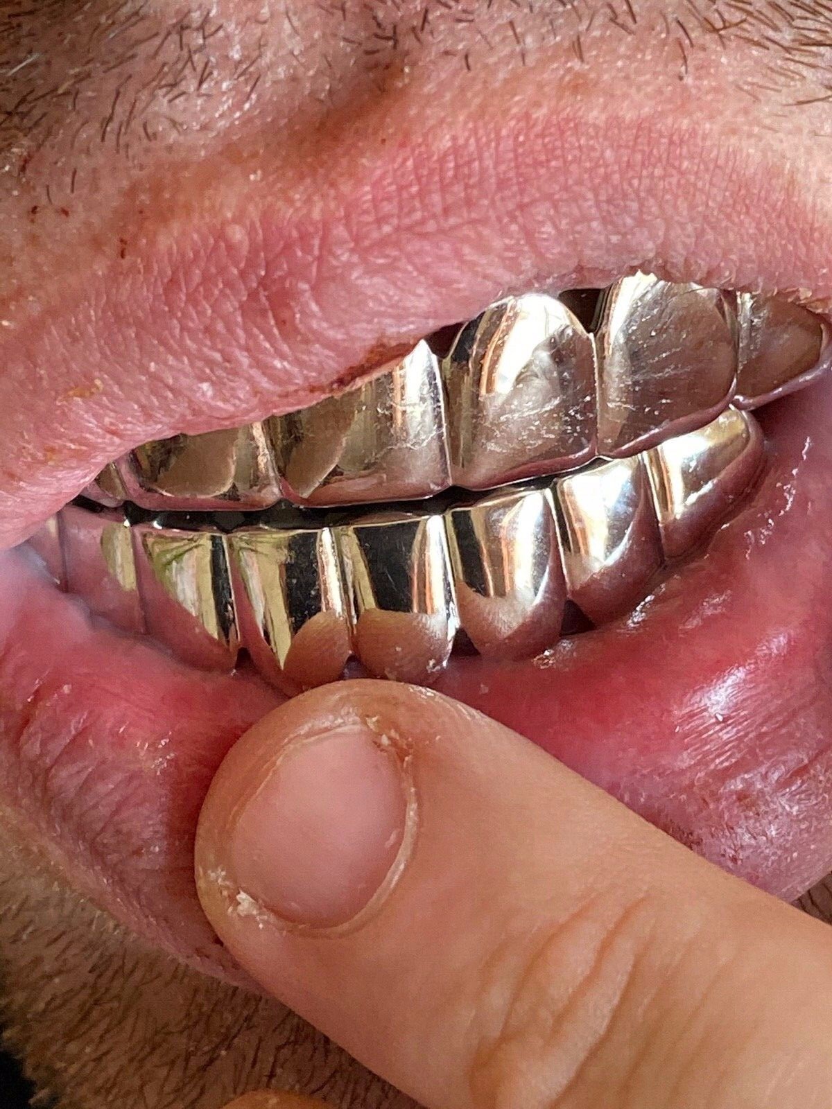 Real 925 Sterling Silver – GRILLZ Top Bottom Hip Hop Grills 6 8 Or Single Teeth