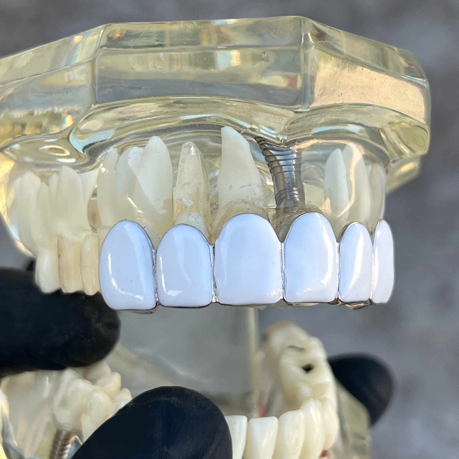 Real Solid 925 Sterling Silver White Enamel Grillz Rapper Grill Six Top Teeth