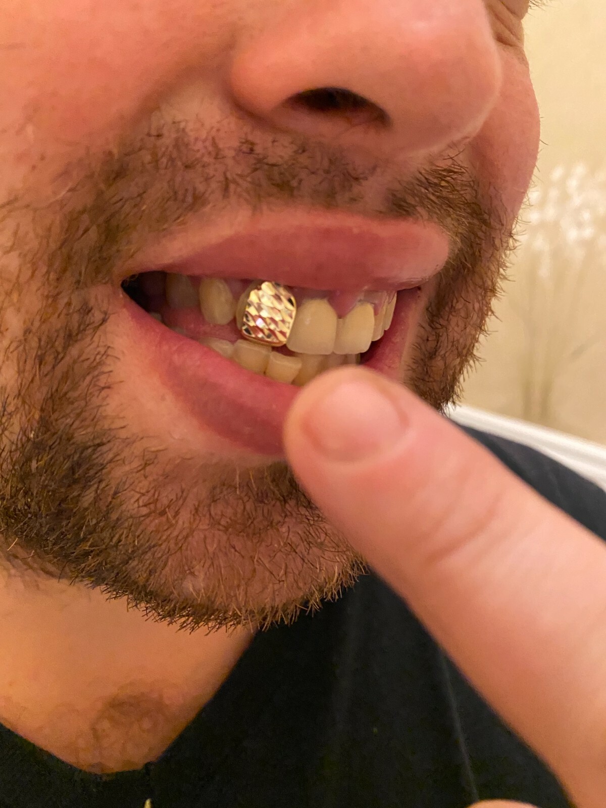 SOLID 925 Sterling Silver Single Tooth Grillz Hip Hop Grill Cap Gold Plated REAL