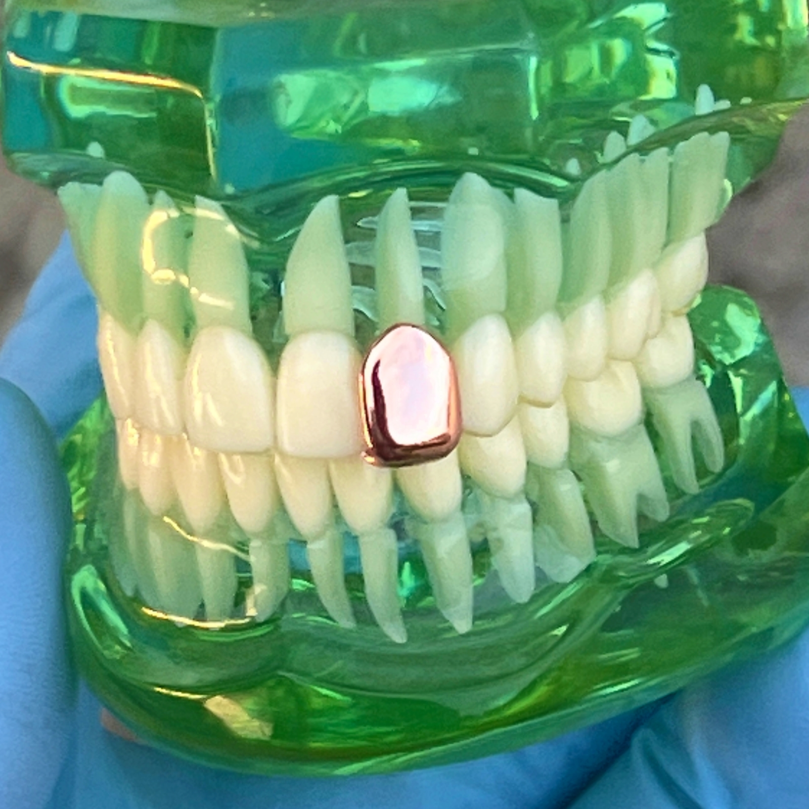 14K Rose Gold Plated Tooth Cap Real 925 Sterling Silver Single One Tooth Grillz
