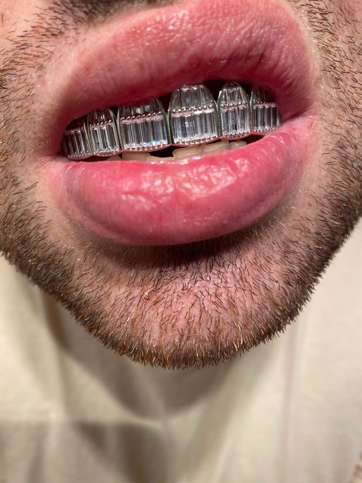 Real Solid Hip Hop 925 Sterling Silver Grillz Baguette Diamond Iced Grills Set