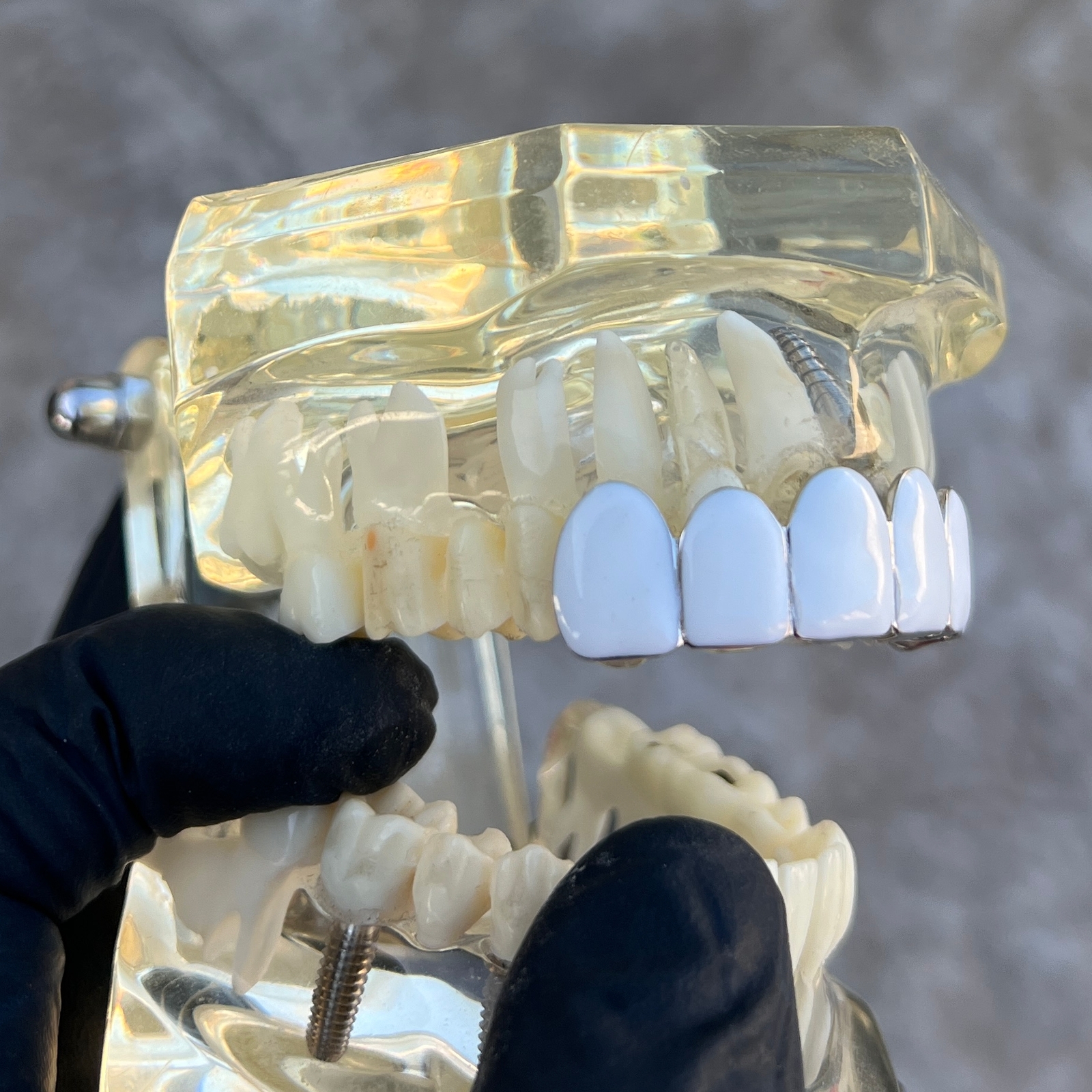 Real Solid 925 Sterling Silver White Enamel Grillz Rapper Grill Six Top Teeth