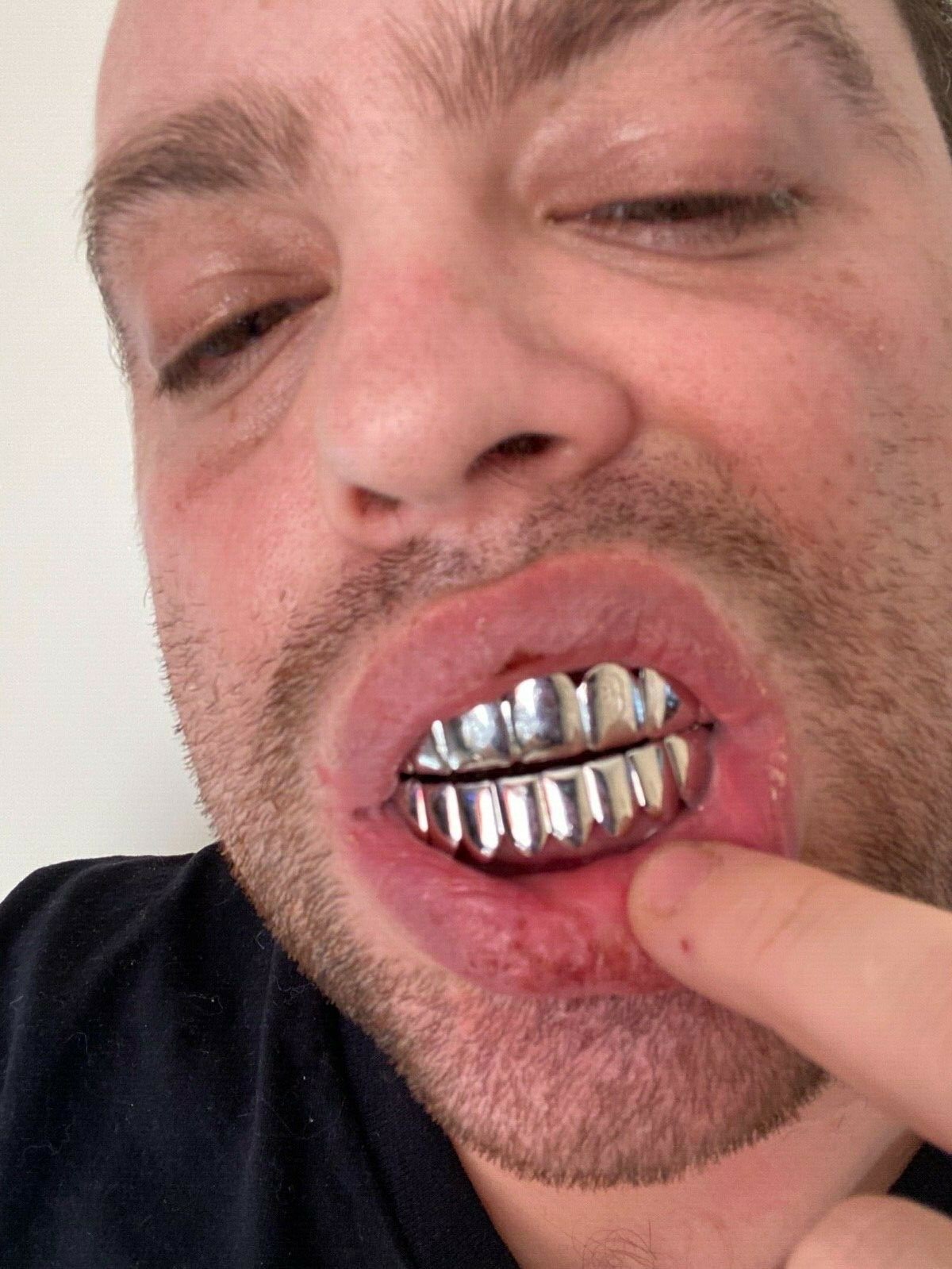 Real 925 Sterling Silver – GRILLZ Top Bottom Hip Hop Grills 6 8 Or Single Teeth