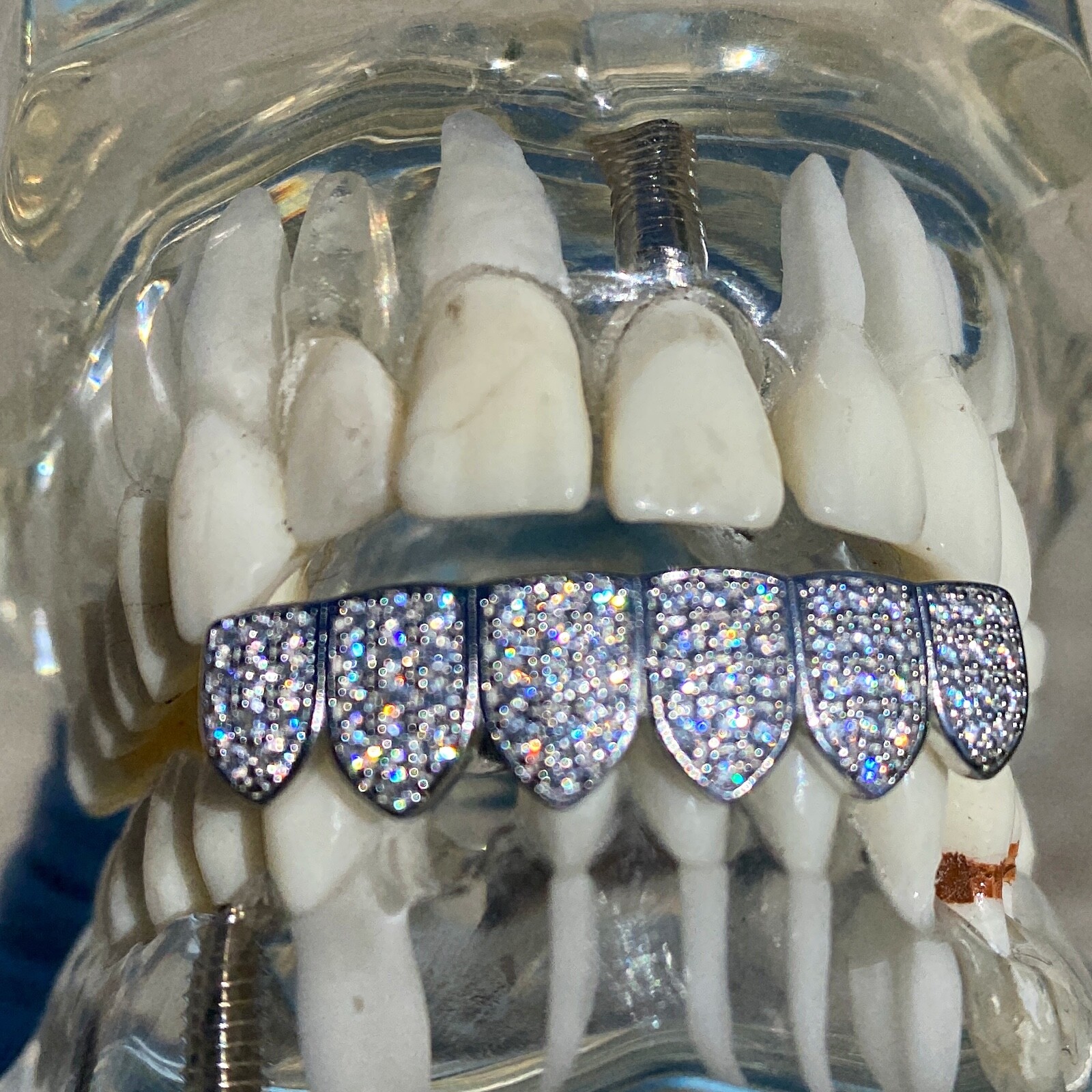 Real 925 Sterling Silver Teeth Grillz Moissanite Micro Pave Iced Flooded Out