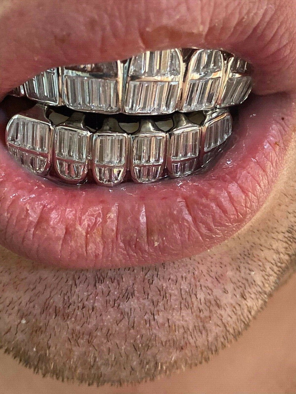 Real 925 Sterling Silver ICED Baguette Rapper GRILLZ Teeth Top & Bottom Set ICY