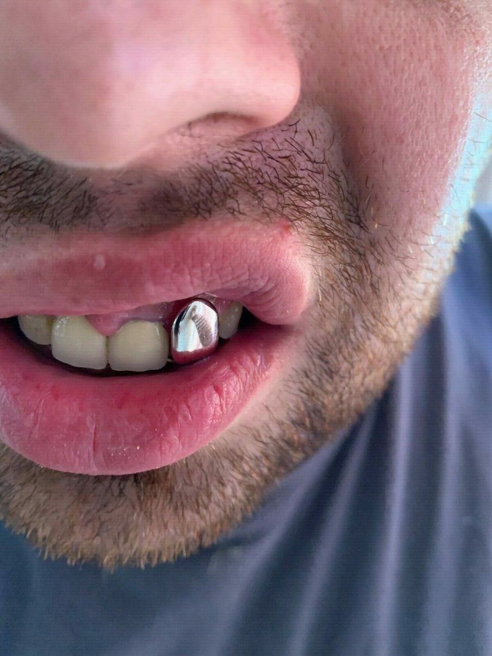 Solid 925 Sterling Silver Single Tooth Grillz Real Custom Hip Hop Grills Caps